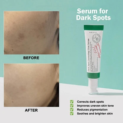 Dark Spot Correcting Glow Serum